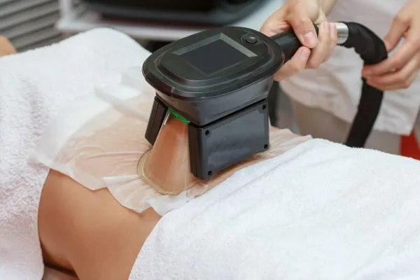 Image of person having fat freezing treatment to help weight gain Esher