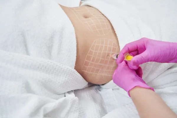 image of fat dissolving injections on love handles to help combat weight gain Esher