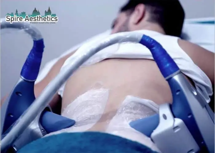 Man having fat freezing treatment done on love handles before a competitions Esher to create a sculpted look.