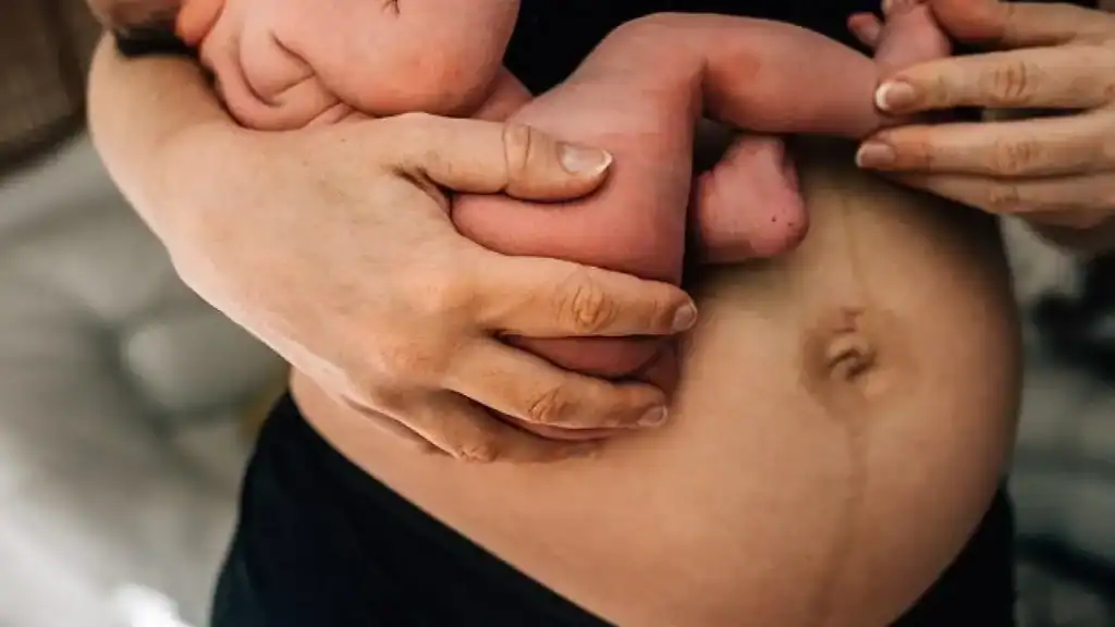 Why Is My Stomach Still Big After Pregnancy Esher?